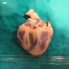 Chat with Jonna Riihikoski´s old heart, the  character AI chatbot