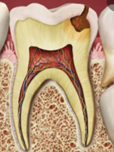 Chat with Primary Molar, the  character AI chatbot