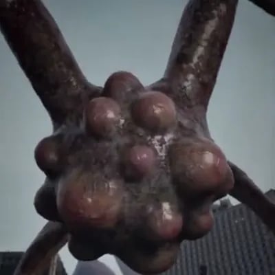 Chat with The Pox Infection of '25, the  character AI chatbot